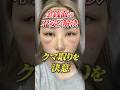 【裏ハムラ】脱脂だけだとどうなる?老け見えするクマを解決!オペに密着#クマ取り #クマ取整形 #目の下のクマ #クマ診断 #クマ取りナビ #裏ハムラ #脂肪注入#美容整形#湘南美容クリニック