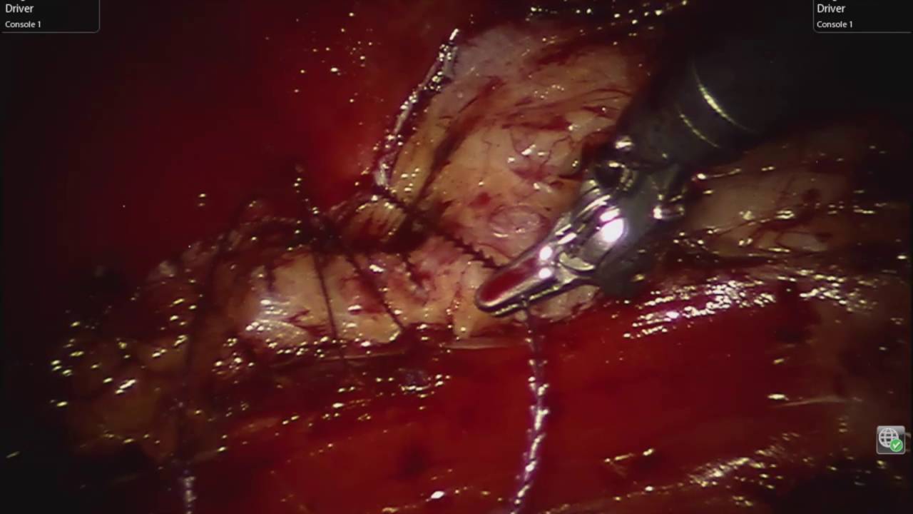 video phone lyrics Robotic Rive Stoppa