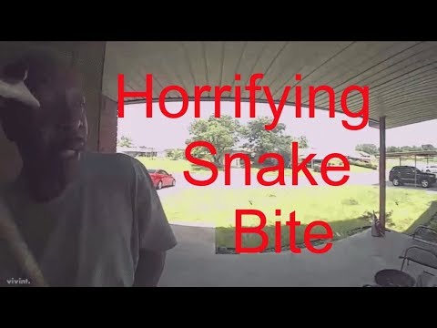Man Gets Snake  Bite  On The Face After Opening a Door In  Oklahoma