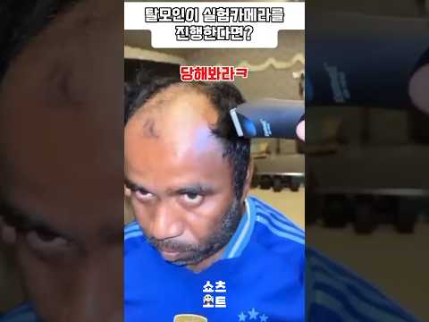 탈모의 설움 #funny