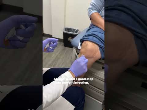 Mono Injection Does Medicare Cover Monovisc Injections