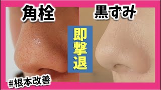 【毛穴黒ずみ撃退法】即効で効く！角質角栓除去！【いちご鼻・黒ずみ・角栓改善】