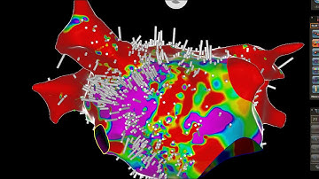 CONFIDENSE WITH RIPLLE MAPPING - BIOSENSE WEBSTER