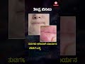 These Daily Habits Increase Oral Cancer Risk! | Kannada | #shorts