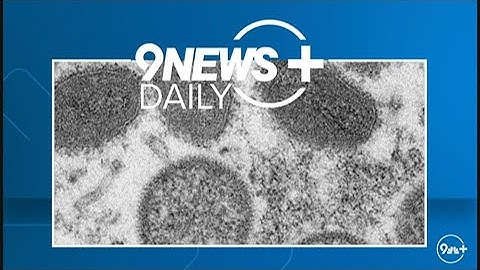 What you need to know about Monkeypox