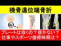 橈骨遠位端骨折プレートは抜くのか抜かない方が良いのか？橈骨遠位骨折はどんな後遺症があるのか、仕事やスポーツの復帰時期はいつごろから？