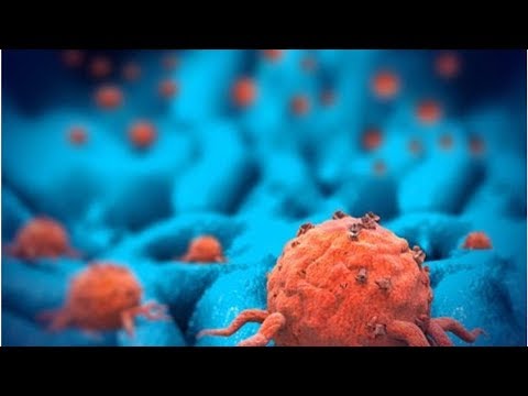 Tumor maligno y benigno, ¿cuáles son las diferencias? | Maha TV