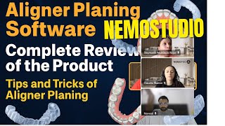 NemoStudio Aligner Software Review |Digital Aligner Planning  Competition 3shape OnyxCeph