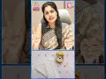 15 రోజులకే నెలసరి | Irregular Periods Problem In Telugu | Dr.K. Anusha Reddy | #shorts