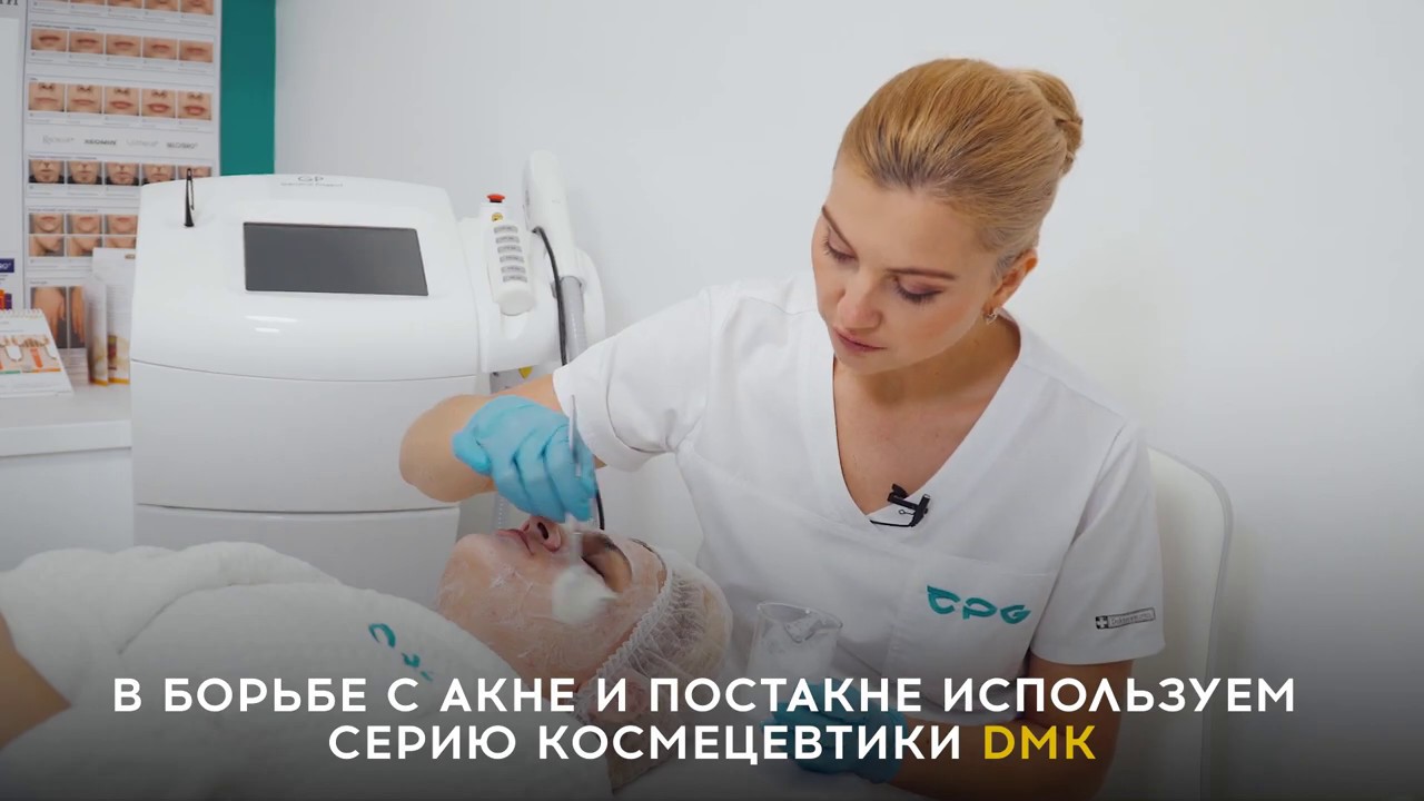 Как вылечить Акне и Постакне? - YouTube