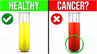 THIS Is What The Color Of Your PEE Is Warning You About Your Health