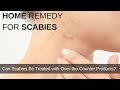 Home remedy for scabies | Can Scabies Be Treated with Over-the-Counter Products?