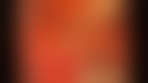 dr Emad Tahir : transabdominal  lap nephrectomy for l ectopic pelvic kidney