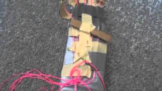 STEM prosthetic hand