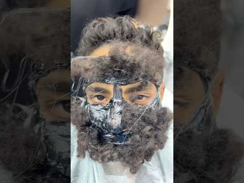 ازالة الشعر المتسلطن من الوجه       