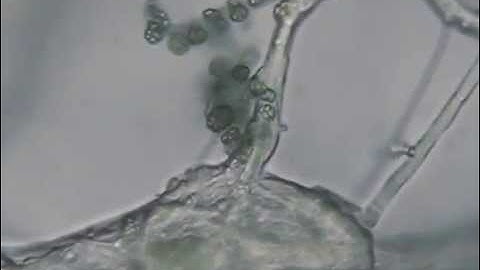 Interaction of Trichoderma mycelium with Phytophthora palmivora (Antagonism)