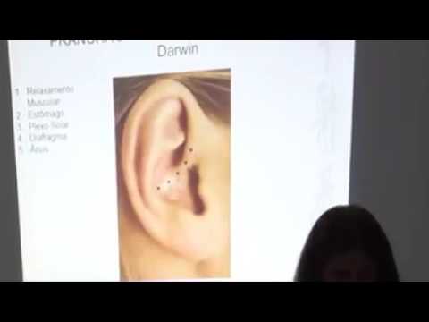 Acupuntura - Auriculoterapia