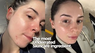 Panthenol Changed my skin.