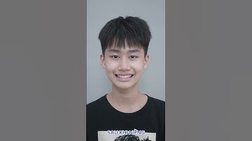 Tháo Mắc Cài Cùng Bạn Huy Hùng Tại Nha Khoa Quốc Tế Việt Mỹ #shorts