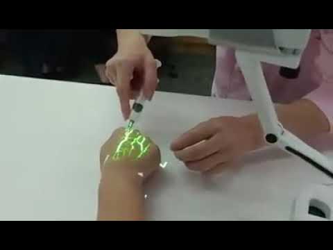 جهاز كشف الاوردة