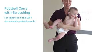Congenital Muscular Torticollis: Carries and Side Bends