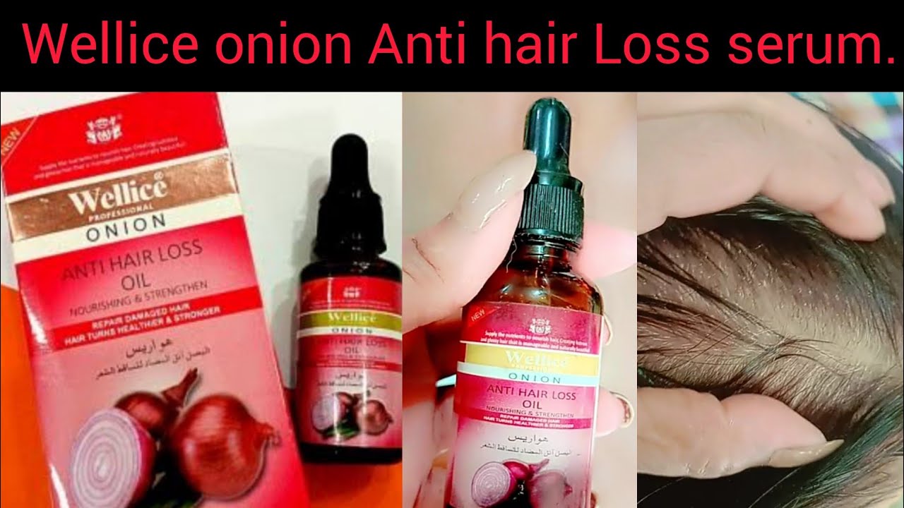 wellice onion hair loss oil. How to use price quality online order