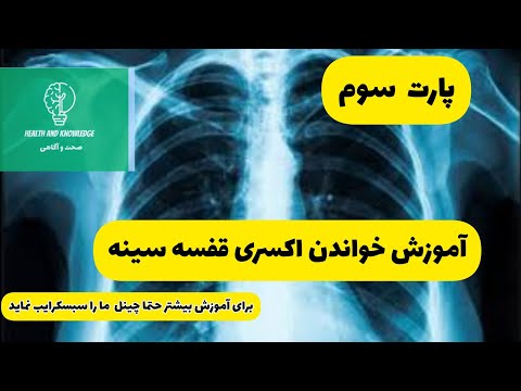 آموزش خواندن عکس قفسه سینه