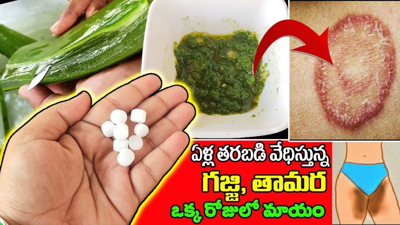 how-to-remove-ringworm