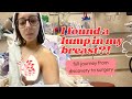 I Found a Lump in my Breast (full journey from discovery to surgery)