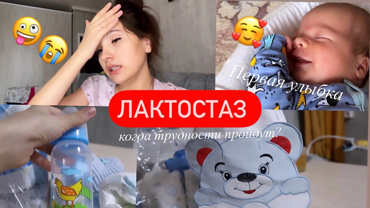 ЛАКТОСТАЗ//СИМПТОМЫ И МОЕ ЛЕЧЕНИЕ//ПЕРВЫЙ ПОДАРОК ДЛЯ МАЛЫША - YouTube
