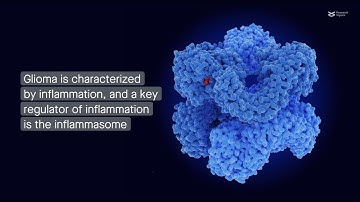 Understanding the dysregulation of the inflammasome in glioma