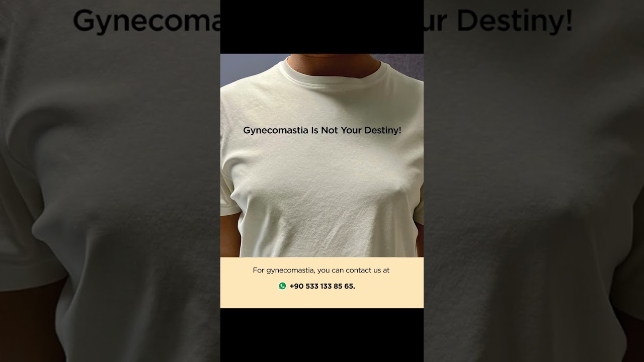 Gynecomastia: A More Masculine and Fit Chest in Just 1 Hour! 💪