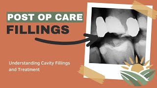 What to do after getting a cavity filled? Post Treatment Instructions and Care