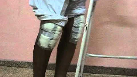 Post Op - Total Knee Replacement - Joints Care - R...