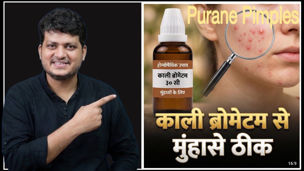 Kali Brom For OLD Chronic Pimpels ! HOMEOPATHIC MEDICINE | How To Use | Symptoms 