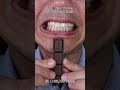 Satisfying Chewing ASMR #Compilation #ASMR #DoctorTristanPeh