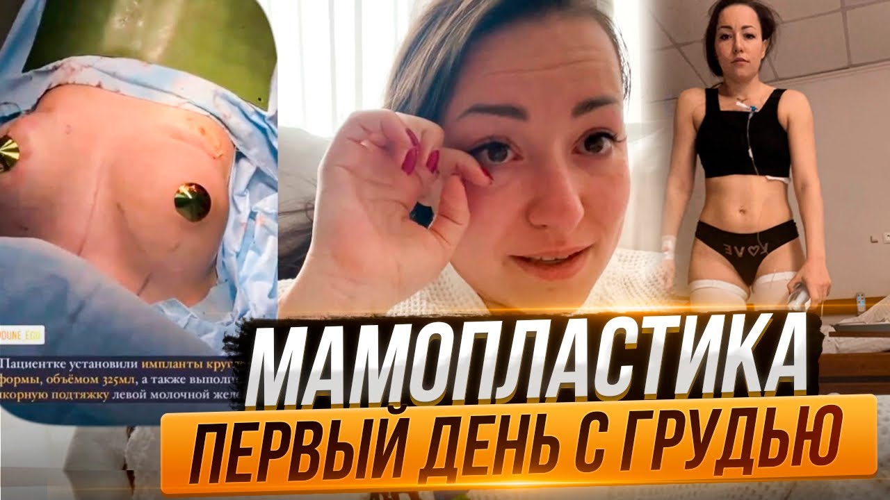 МАМОПЛАСТИКА. Операция по увеличению груди. Увеличение груди. Первый ...