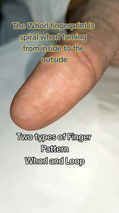 Pattern of finger prints and characteristics #finger #loop #whorl #palmist #hand #palm #دستشناسی