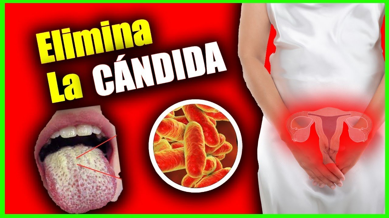 Cómo Eliminar la Cándida.Cómo evitar y tratar la candidiasis. - YouTube