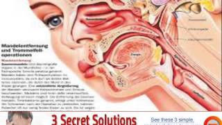 conduction deafness psychology definition