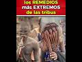 Los Remedios Más RAROS y EXTREMOS de Tribus del Mundo que No Creerás 😱