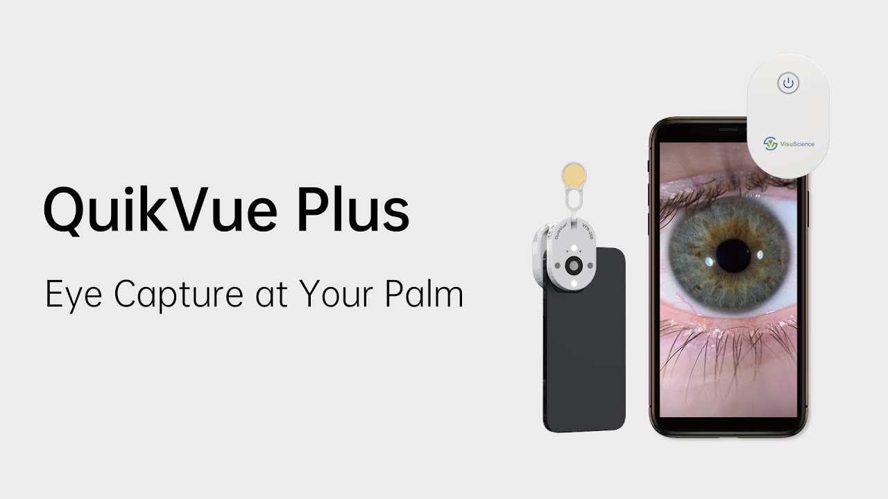 QuikVue Smartphone Eye Imaging Adaptor - Products - VisuScience