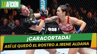 Irene Aldana sufre brutal corte en el rostro en su derrota ante a ...