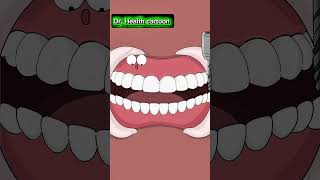 How Full Mouth Implants Completely Replace 🪥 #dentalimplants #dentist #dental #teeth #smile