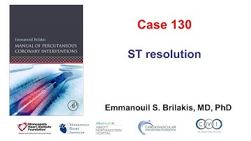 Case 130:  PCI Manual - ST elevation resolution