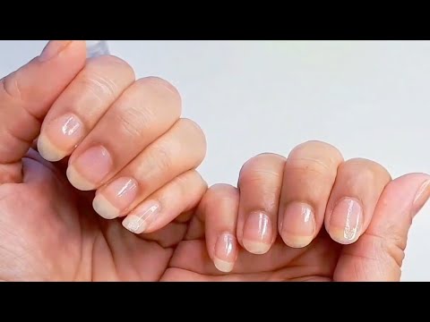 caseros remedios hemorroides Remedio para crecer las uñas y fortalecerlas.💅💅💅