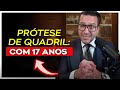 Prótese de quadril DOS DOIS LADOS com 17 anos. Quais recomendações?