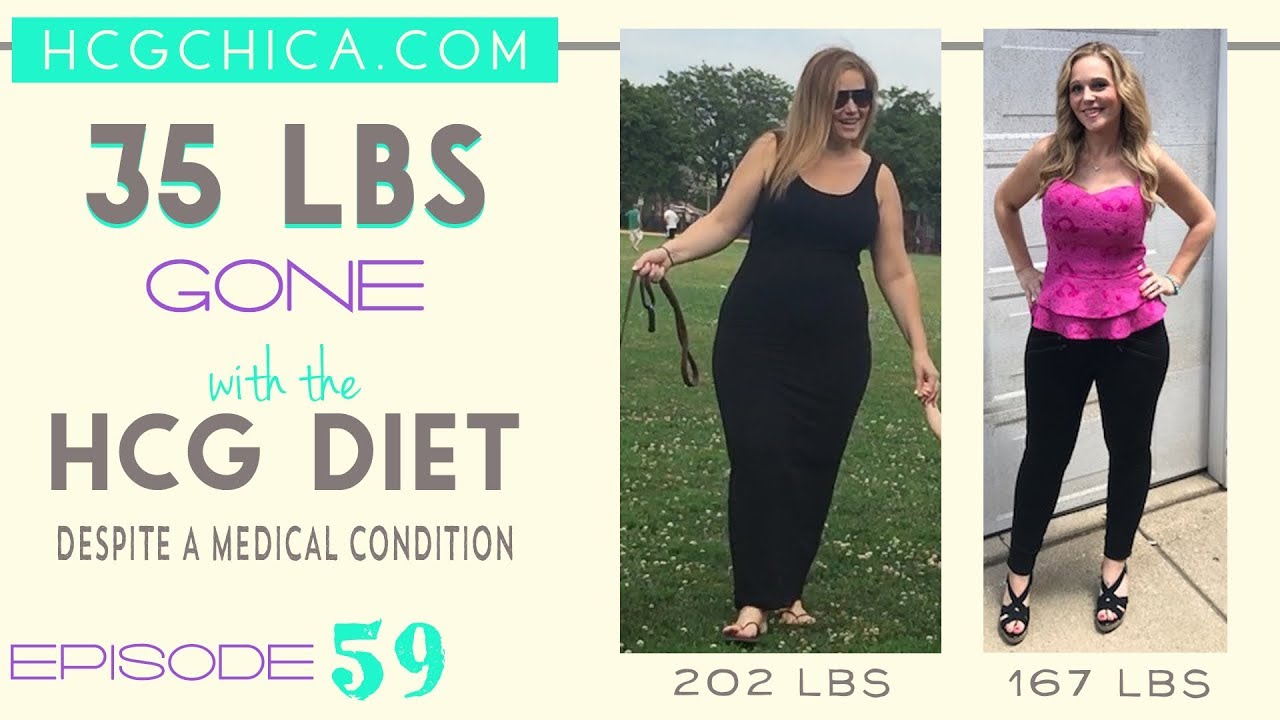 hCG Diet Interviews - Episode 59 - Jenna