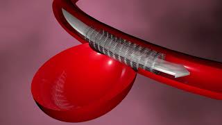 Renal denervasyon nedir? - Prof. Dr. Ali Oto (Kardiyoloji)