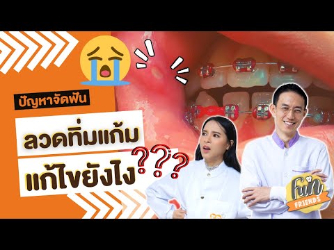 ลวดทิ่มแก้ม ลวดงอ เหล็กจัดฟันตำเหงือก แก้ไขยังไง? |จัดฟันที่แท้ FunFriends เพื่อนกันฟันดี|